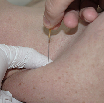 servicios-fisioterapia-traumatologica-e-invasiva